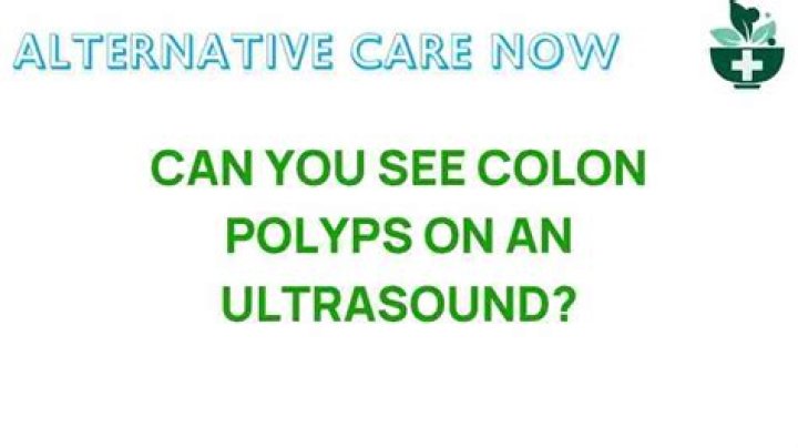 Can you see colon polyps on an ultrasound?