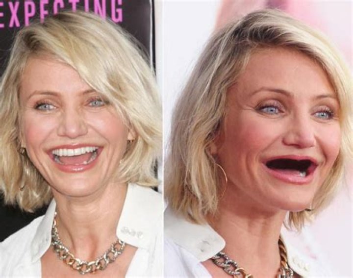 How do Hollywood stars have perfect teeth?