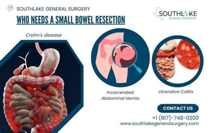 How do they remove a bowel obstruction?