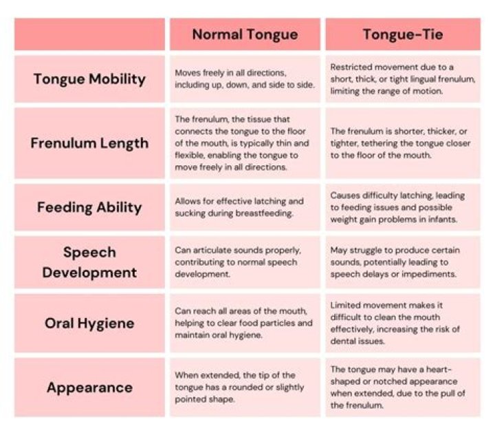 What is mild tongue-tie?