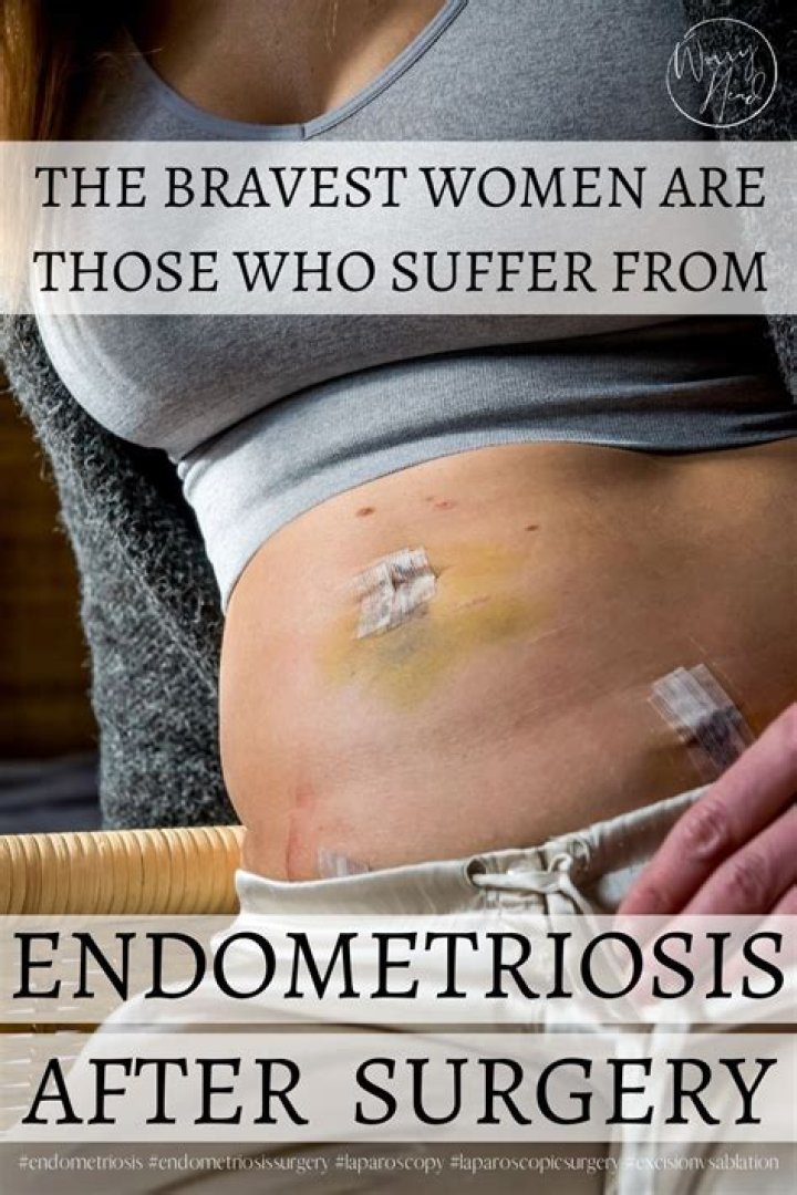 What should I wear after endometriosis surgery?