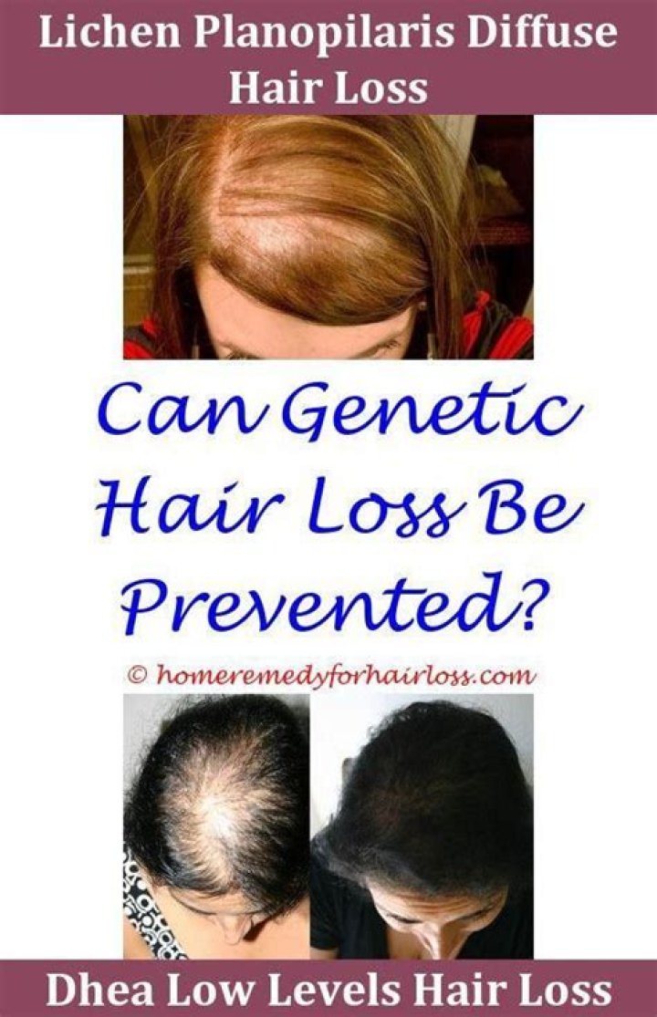 What would a dermatologist prescribe for hair loss?