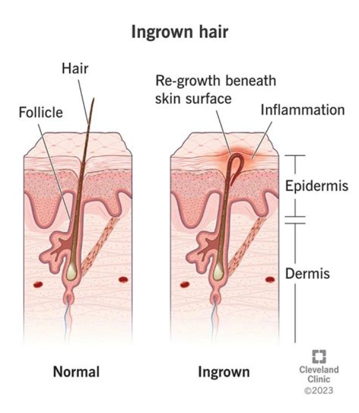 Why does hair grow on private parts?